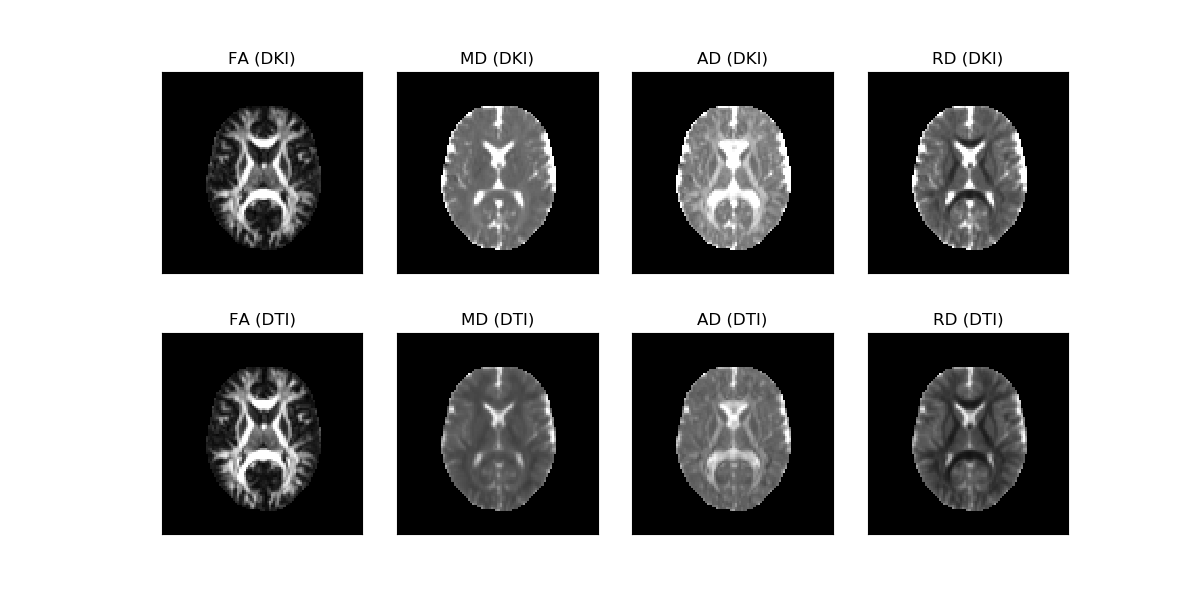 ../_images/Diffusion_tensor_measures_from_DTI_and_DKI.png