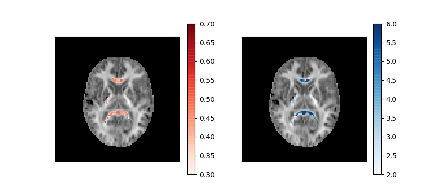 ../_images/Kurtosis_Microstructural_measures.png