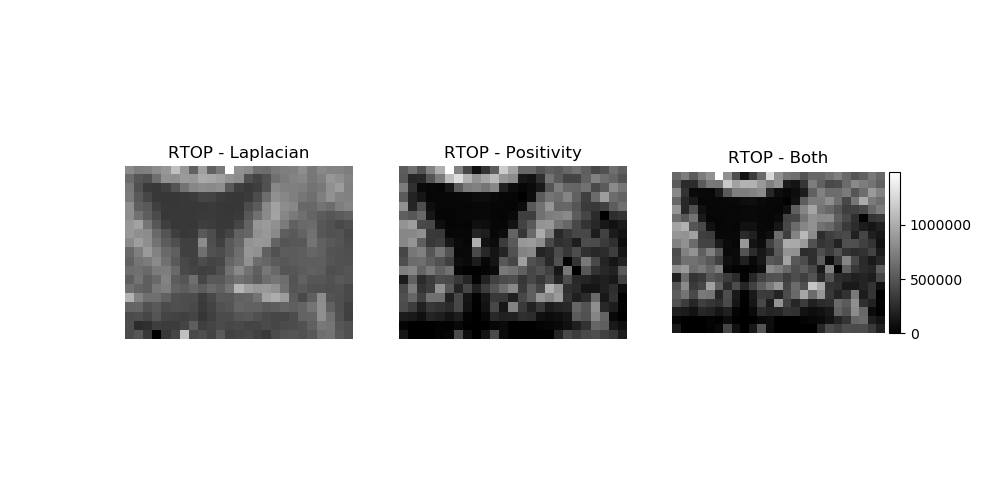 ../_images/MAPMRI_maps_regularization.png