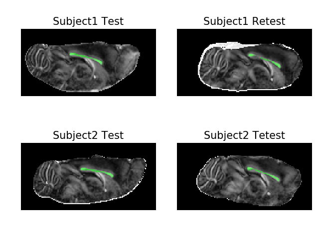 ../_images/qt-dMRI_datasets_fa_with_ccmasks.png