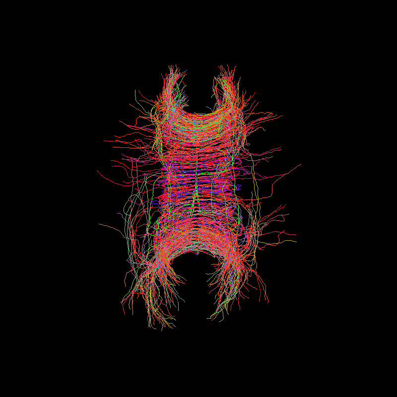 ../_images/tractogram_probabilistic_dg_sh_pfm.png