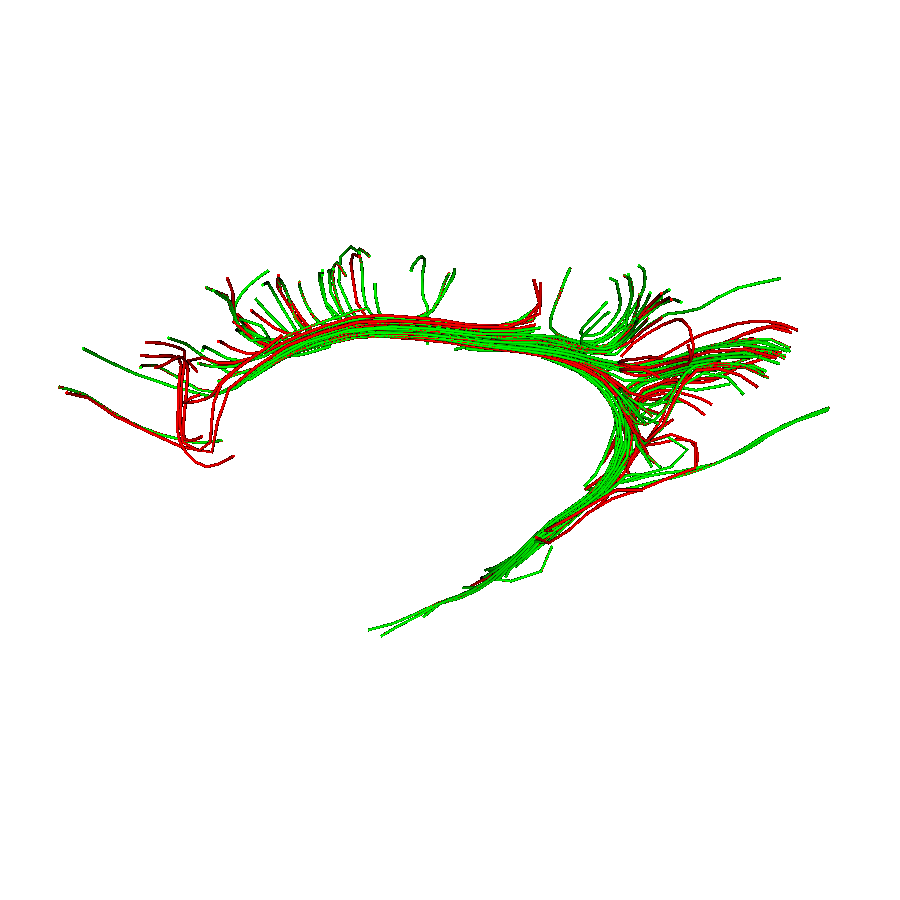 bundle shape similarity