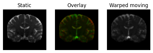 syn registration 3d