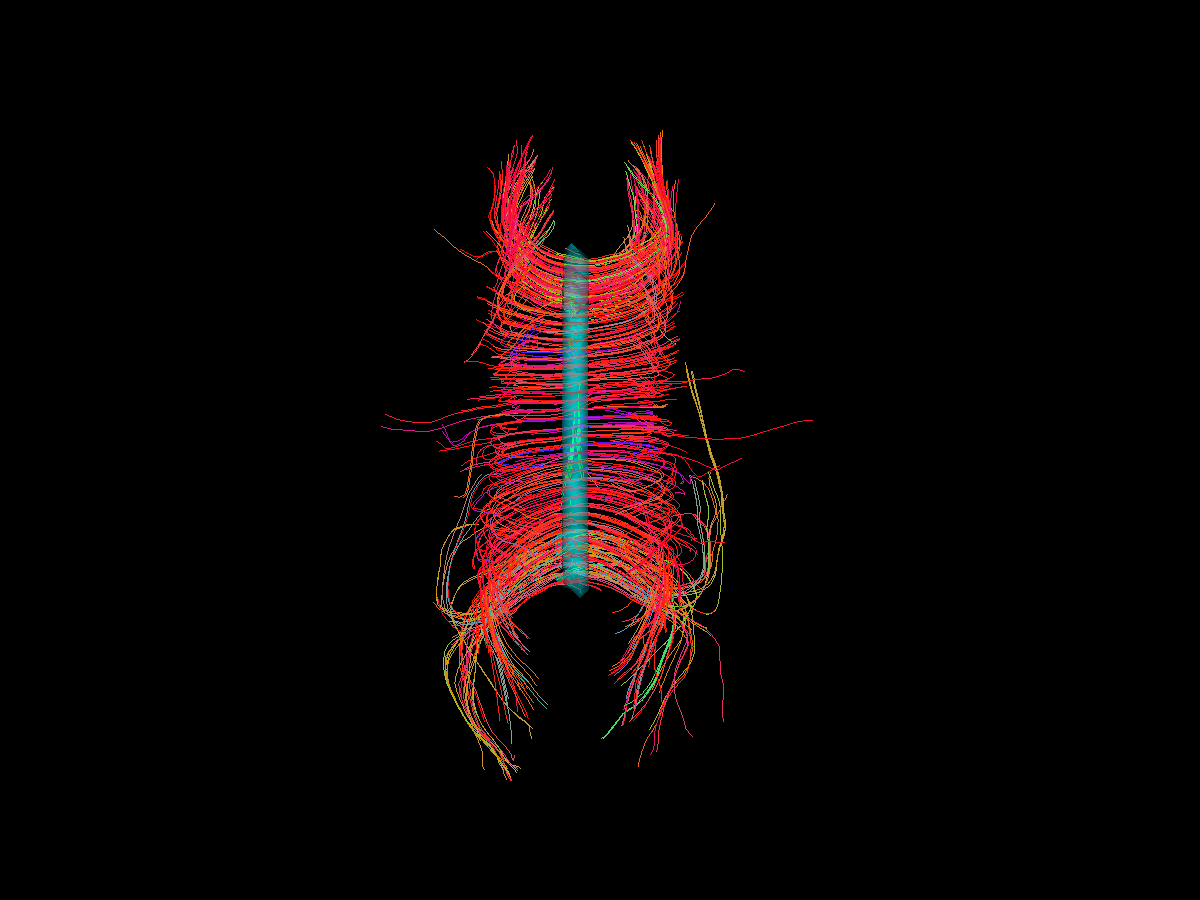 viz roi contour