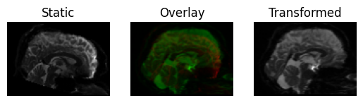 affine registration 3d