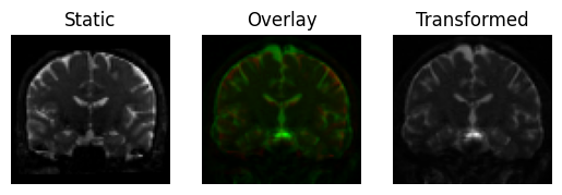 affine registration 3d