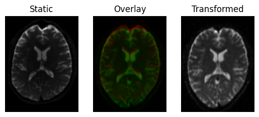 affine registration 3d