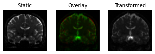 affine registration 3d