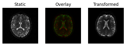 affine registration 3d