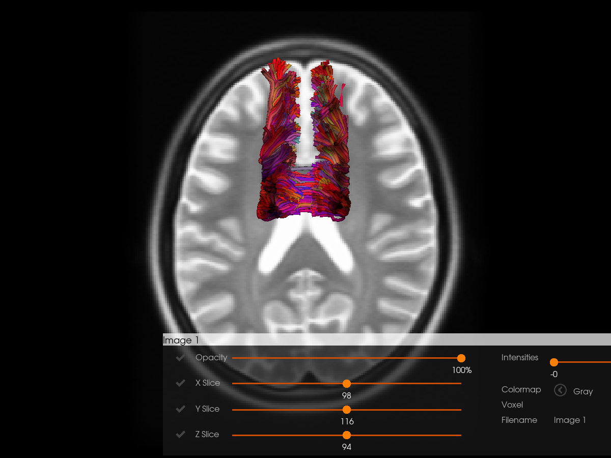 streamline registration