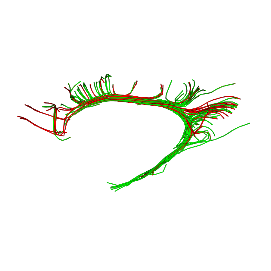 bundle shape similarity