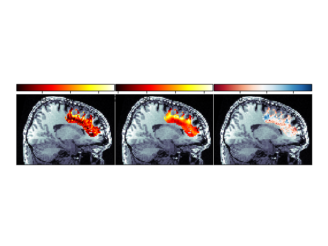 linear fascicle evaluation