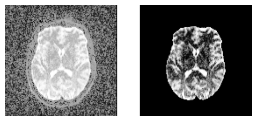 brain extraction dwi