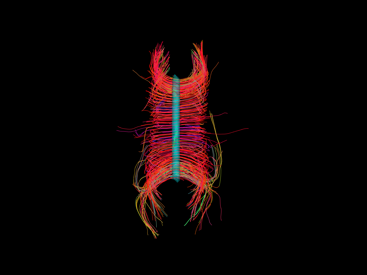 viz roi contour