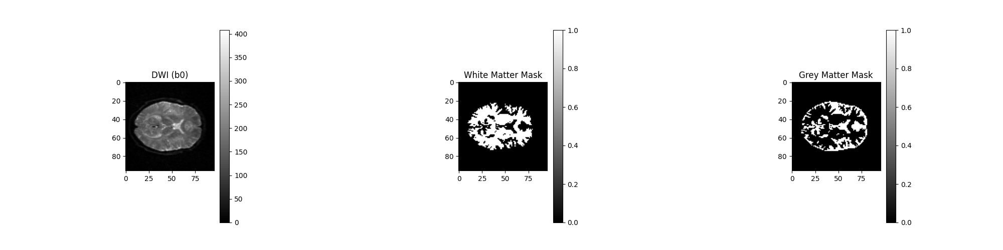 tissue classification dam